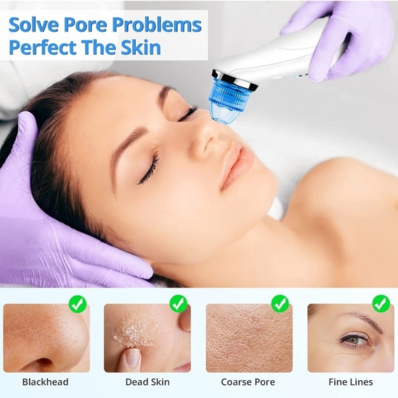 Blackhead Remover Pore Vacuum - Fabuday Blackhead Skin Cleaner Extractor Tool - Picture 2 of 7